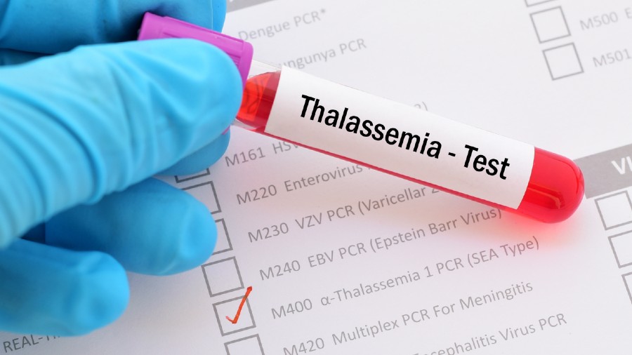 A single test before marriage or before planning a child can prevent the birth of a thalassemic child, a doctor said at a seminar on thalassemia on Saturday