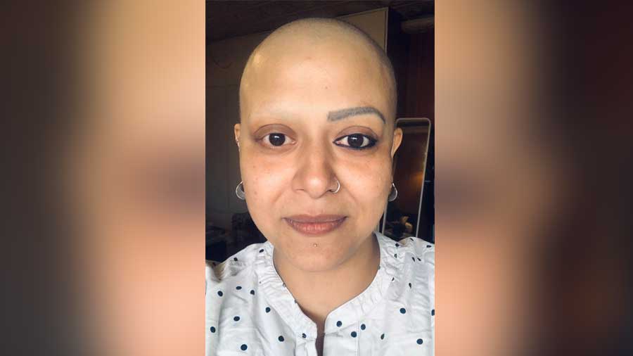 Seal painted her brows when she lost hair during her chemotherapy treatment
