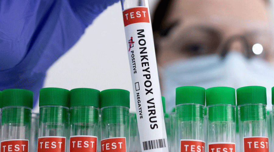 Monkeypox: Samples of deceased tests positive