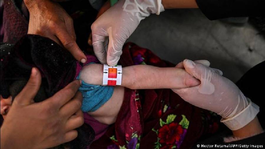 Many people in Afghanistan suffer from malnutrition, according to international groups