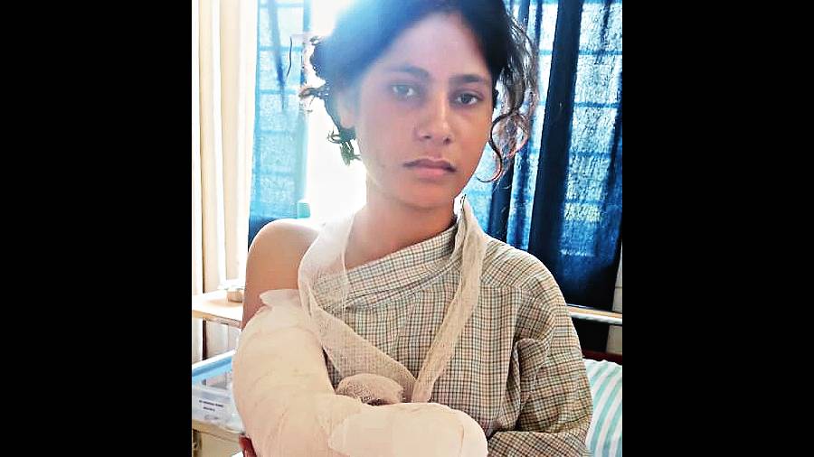 Renu Khatun after her right hand was chopped off 