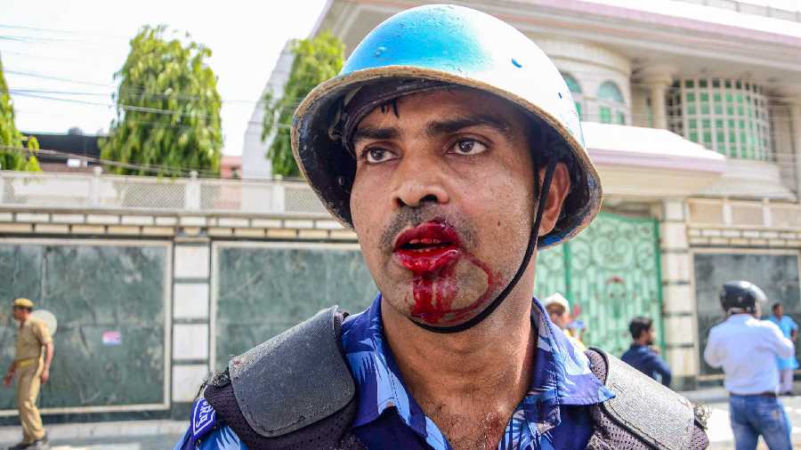  A Rapid Action Force (RAF) personnel injured while trying to maintain law and order during a protest at Atala area in Prayagraj