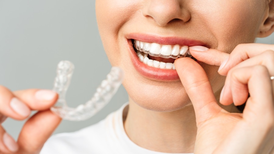 FAMILY BRACES • Hidden Braces vs. Invisalign