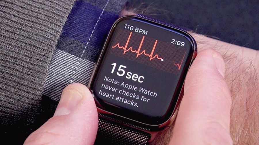 ECG monitoring using the Apple Watch