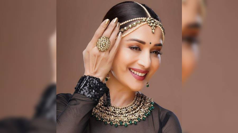 The million-dollar-smile