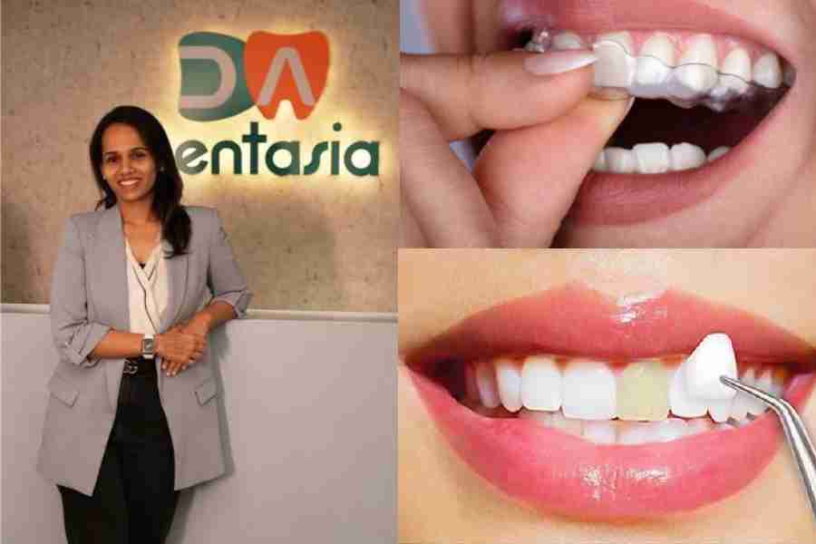 (left) PREETI (GULGULIA) BOTHRA, (up) A woman putting a transparent aligner on her teeth. (below) Veneers go on the front of the teeth and improve smiles.