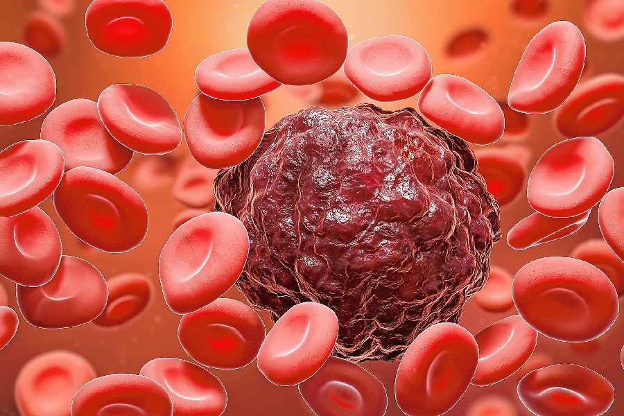 A 3D rendering of a cancer cell amidst red blood cells