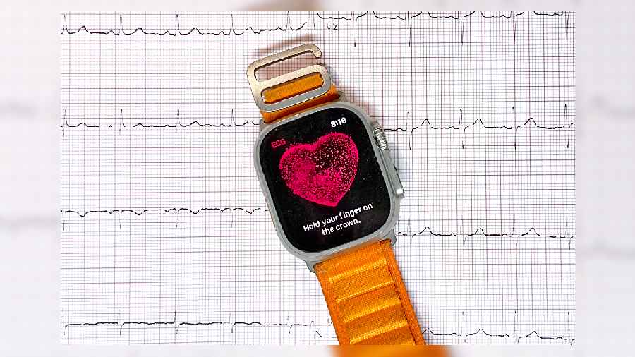 Apple Watch has changed the relationship between the medical community and patients without compromising on privacy