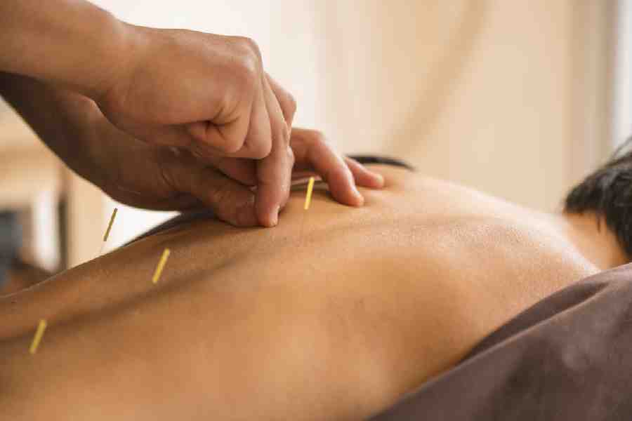 Acupuncture treatment promotes blood circulation, removes blood stasis and regulates qi