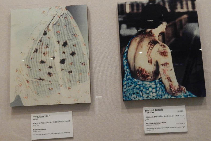 Dark patterns on a kimono imprinted on the body of a wearer in the intense heat generated by the bomb