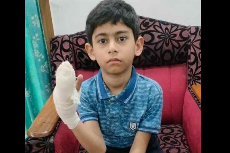 Aban Ashraf, 8, whosehand was run over by acab on Tuesday.