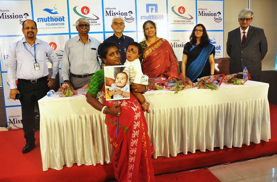 Techno India Dama Hospital, in collaboration with Mission Smile and Muthoot Pappachan Foundation, is conducting a comprehensive Cleft Surgical Camp, offering free cleft surgeries to children and young adults. The five-day mission will be held from June 26 to 30 