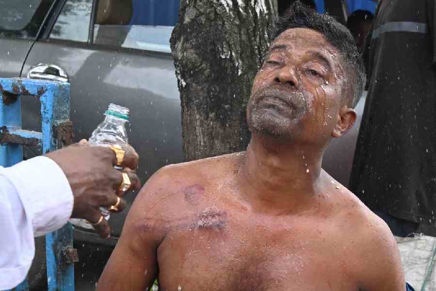 A protester injured during a lathi charge in the Park Street area during the Nabanna Abhijan on August 9, 2025.