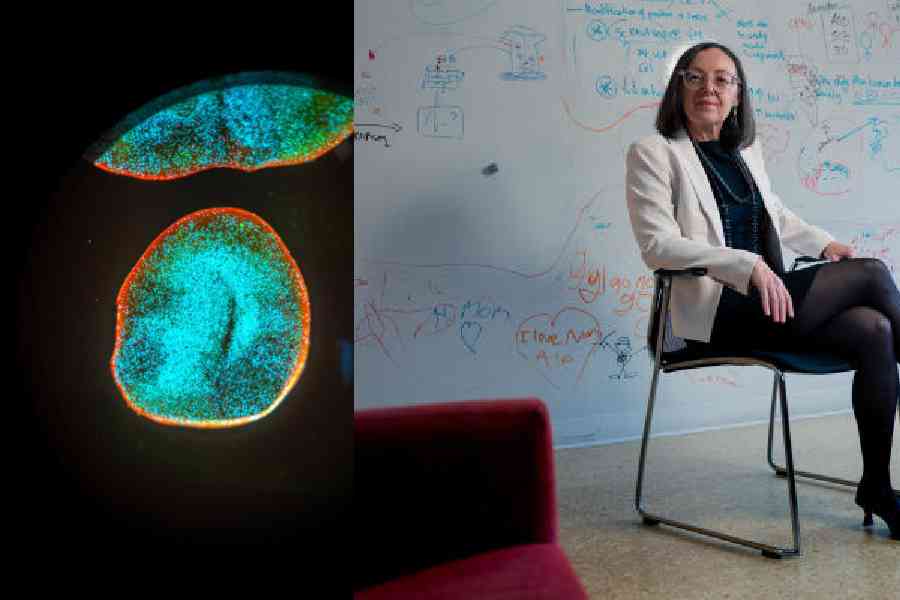 Organoid samples on a slide. Organoids are lab-grown collections of human nerve cells, Paola Arlotta