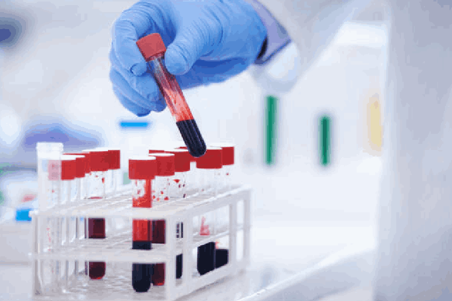 Representational picture