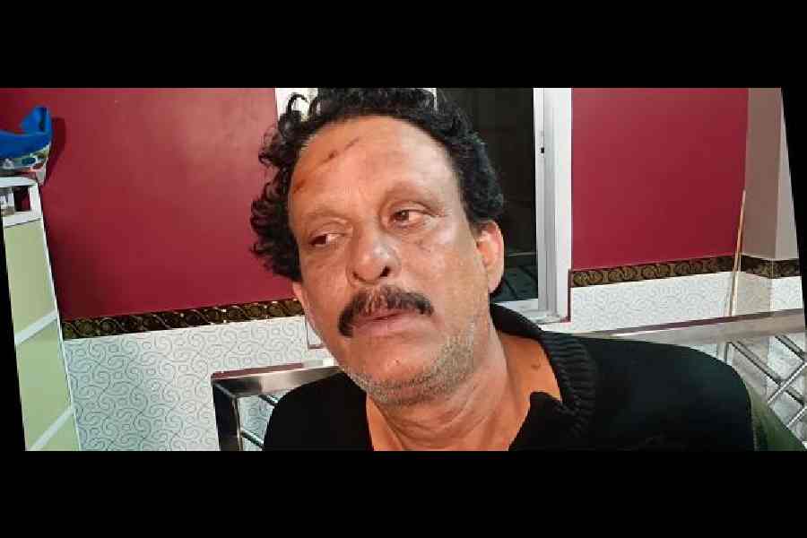 An injured Bholanath Ghosh at his home in Sarberia, Sandeshkhali, on Wednesday evening.