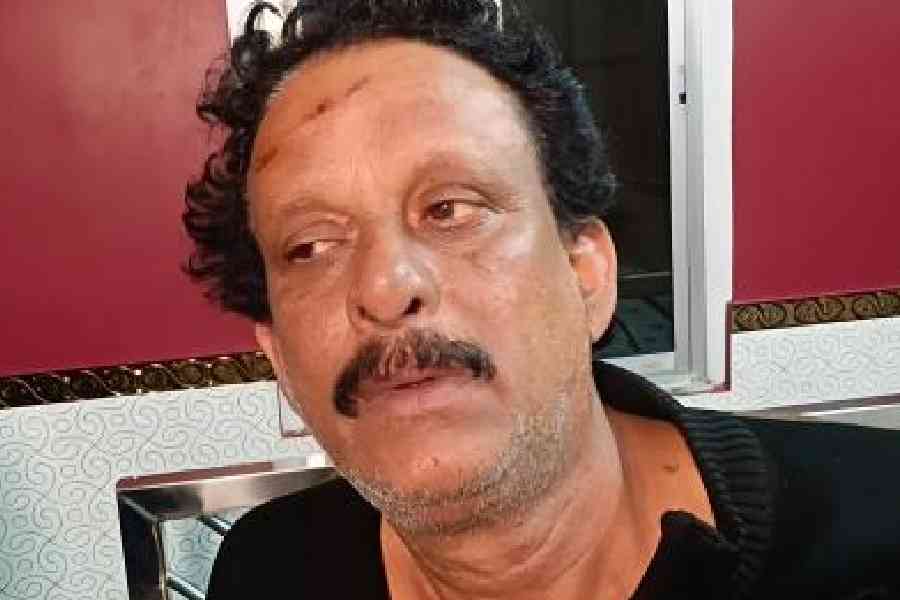 Injured Bholanath Ghosh at home in Sarberia of Sandeshkhali after the crash last Wednesday that killed his son and his driver