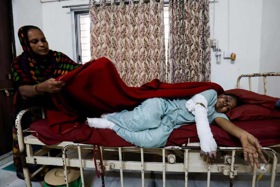 Sita Patni, 45, who suffered injuries when smouldering projectiles from the crashed flight hit her on the ground. (Reuters)