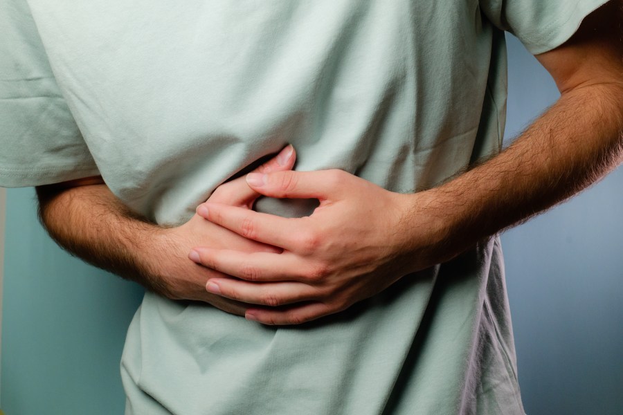 Nausea, vomiting, and abdominal discomfort are common side effects of tirzepatide