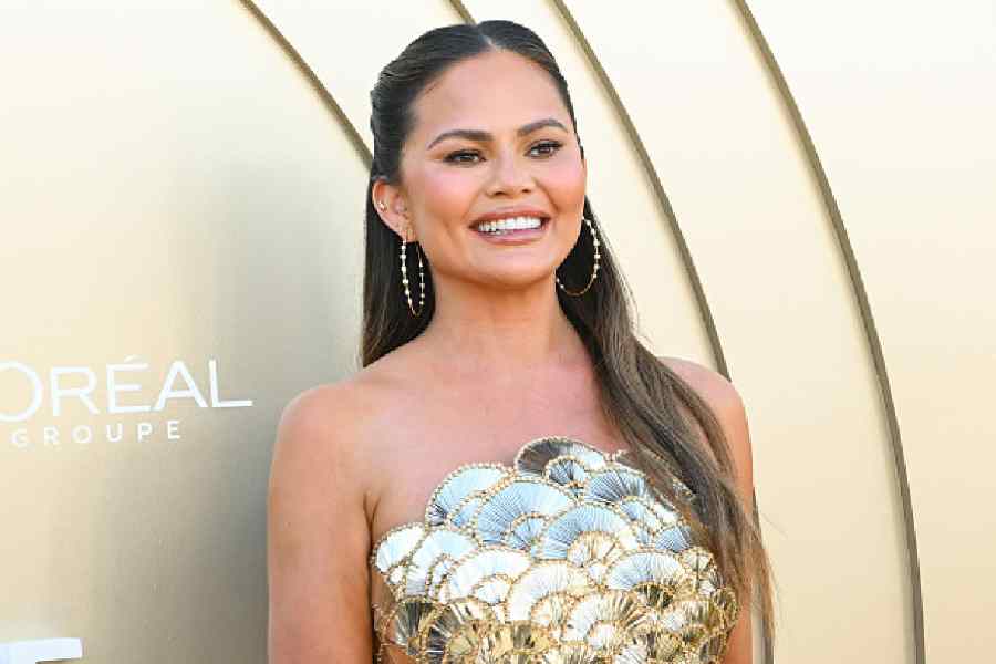 Chrissy Teigen has always been transparent about her cosmetic surgeries and procedures