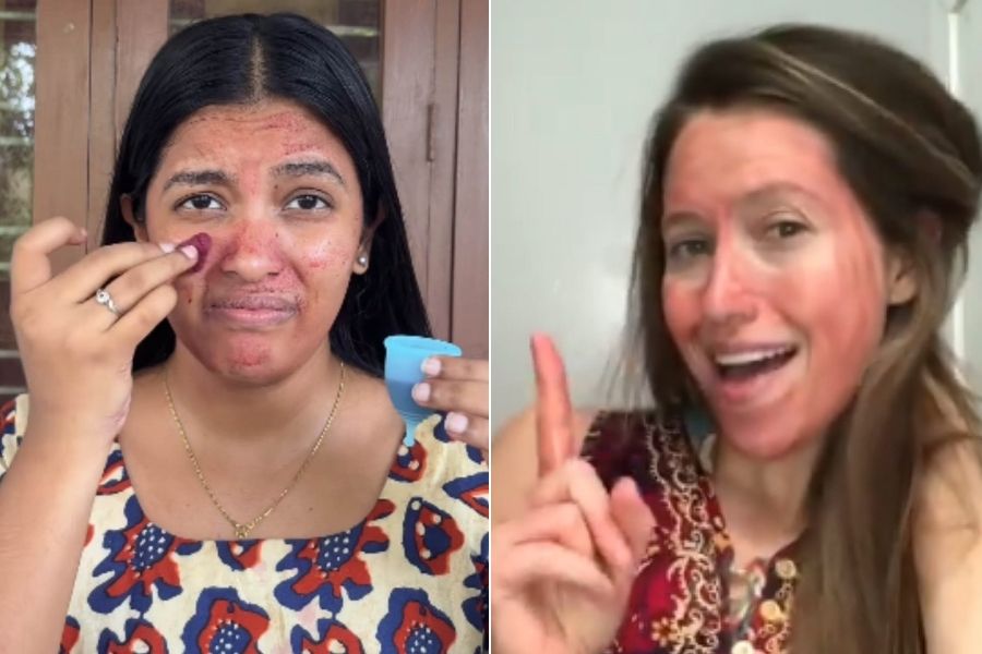 Doctors have highlighted the bacterial reactions these masks can cause to one’s face