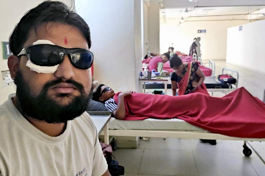 A Diwali reveller who suffered an eye injury while using a carbide gun undergoes treatment at a Bhopal hospital on Friday.