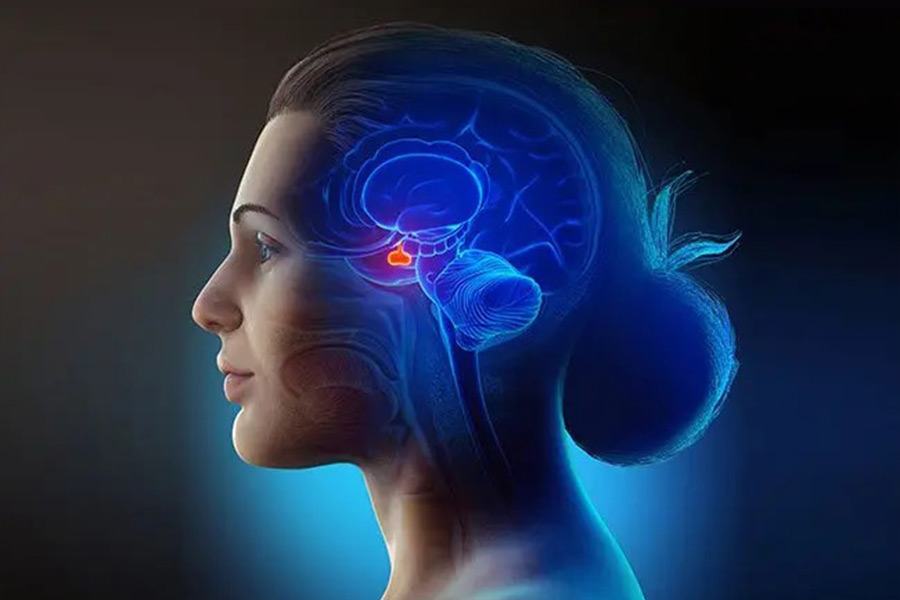 Representative Image