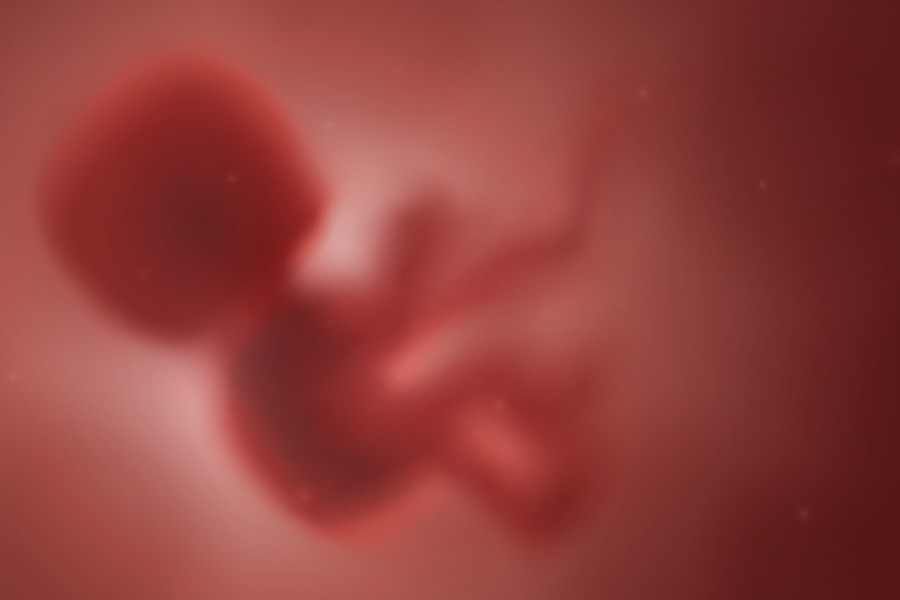 Representational image