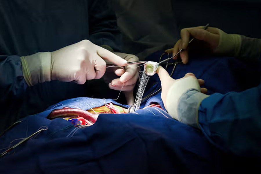 Heart surgery performed through laparoscopy