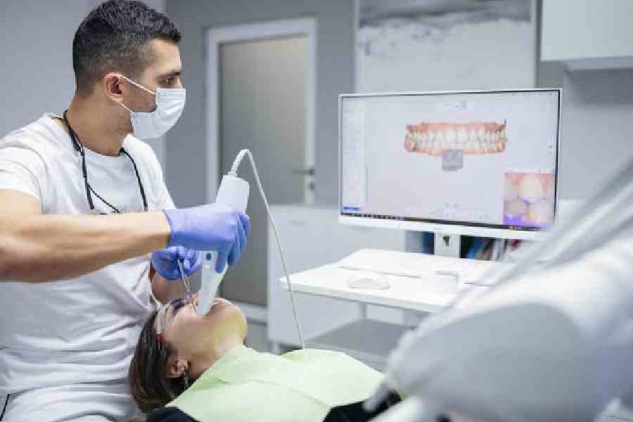 Young woman having her teeth scanned with 3D tooth scanner technology