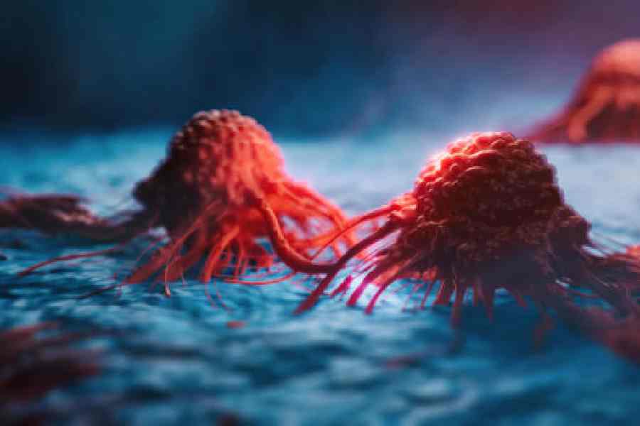 Representational picture