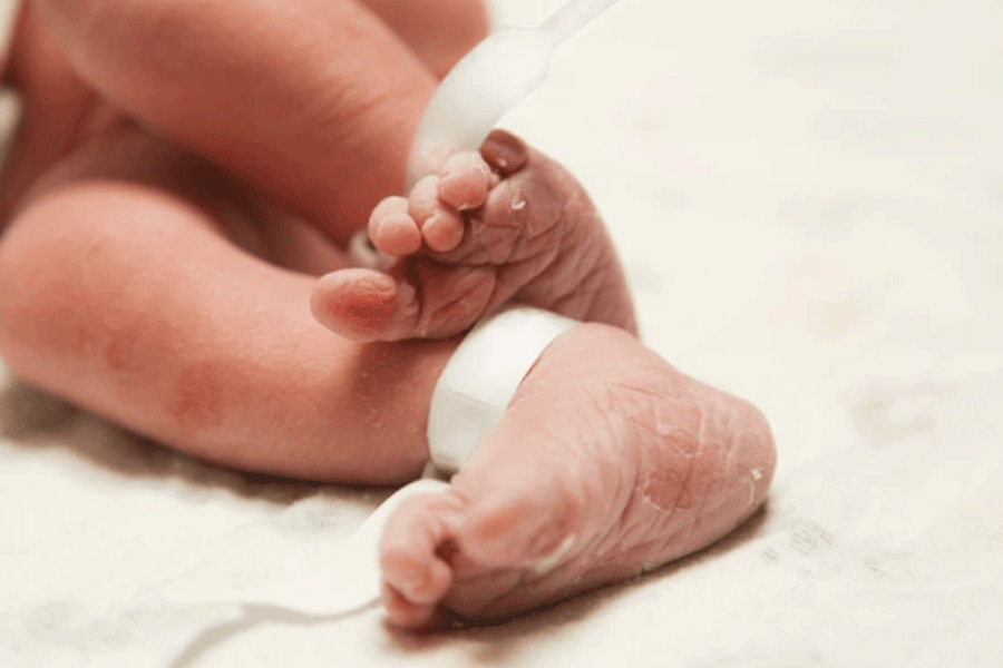 Representational image.