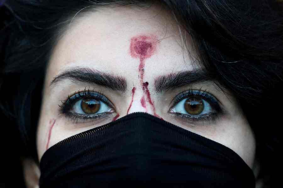A woman with a bullet wound mock-up at a Rome rally in support of the nationwide protests in Iran earlier this month.