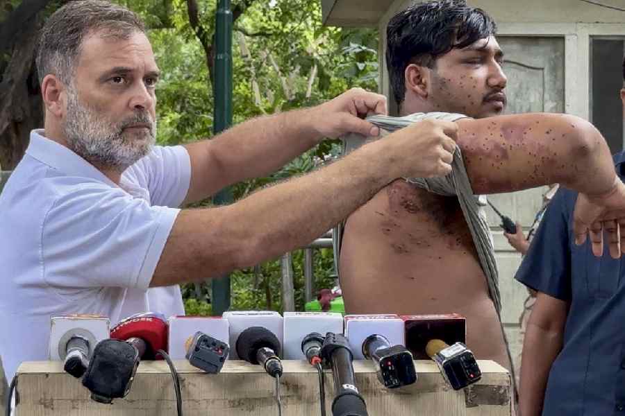 Protesters Injured During Cockroach Janta Party's 'Sansad Chalo' March