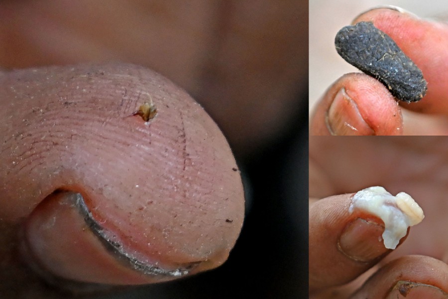 A bee stinger (L), Propolis (top right), Royal Jelly (bottom right)