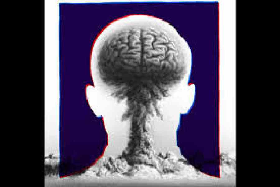 China approves brain computer interface for commercial use