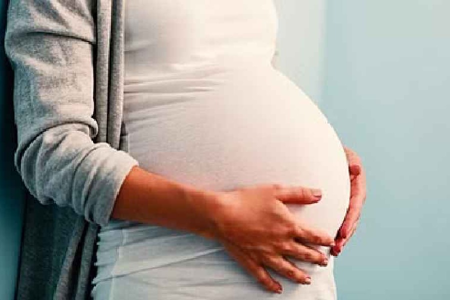 Representational Image