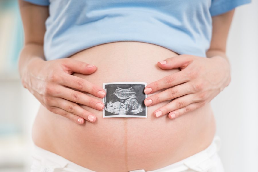 Representational image