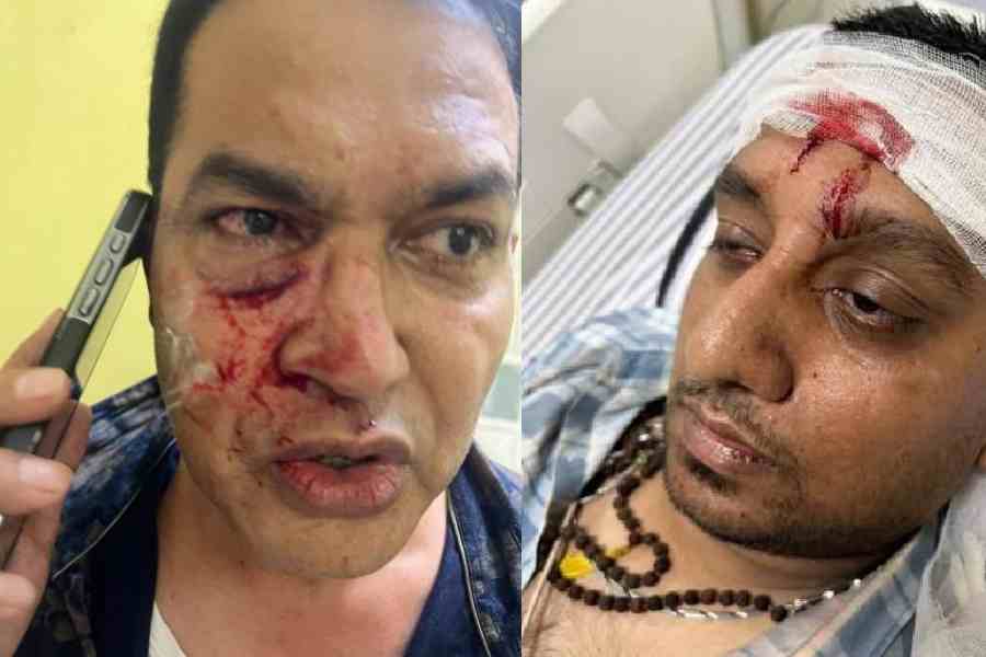 Former IPS Officer Alleges Assault as TMC Rally Attacked