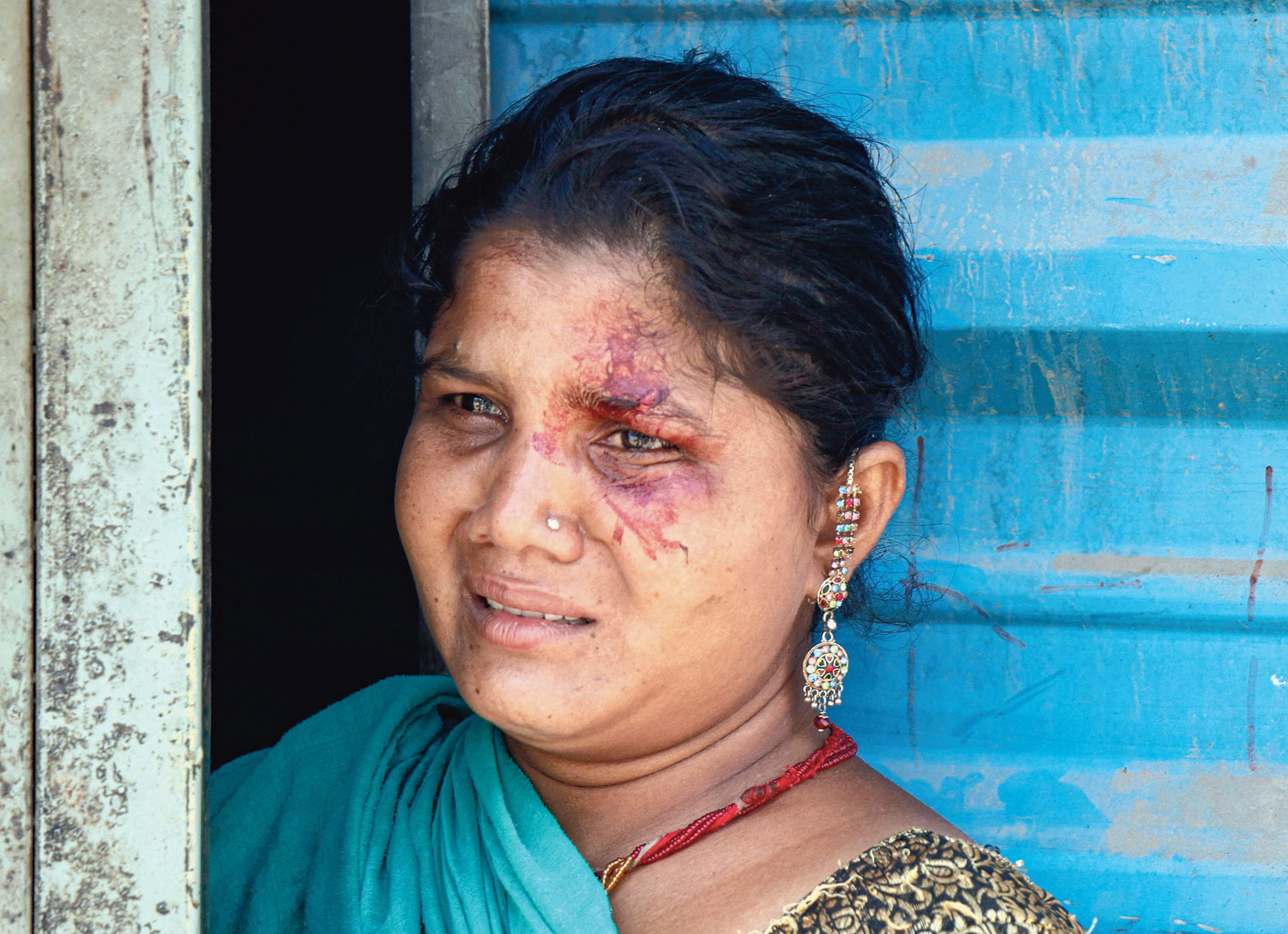 The wife of a migrant worker injured in a protest in Ahmedabad on Monday.
Police fired tear gas and rained lathis to disperse a crowd of migrant workers who had gathered on an Ahmedabad road to demand to be allowed to return home. Around 100 were detained, police said.
Joint commissioner of police Amit Vishwakarma said the migrant workers from different states had been asking the local authorities for many days to send them back home.
“Around 400 to 500 migrant workers
live at the labour colony and work at a nearby construction site. They are demanding since long that they be sent back. When
some of them gathered on the road on
Monday over the same demand, the police asked them to go back and have patience,” he said.
“However, they suddenly got angry and engaged in stone pelting. It was a sudden outburst... not directed at police.”