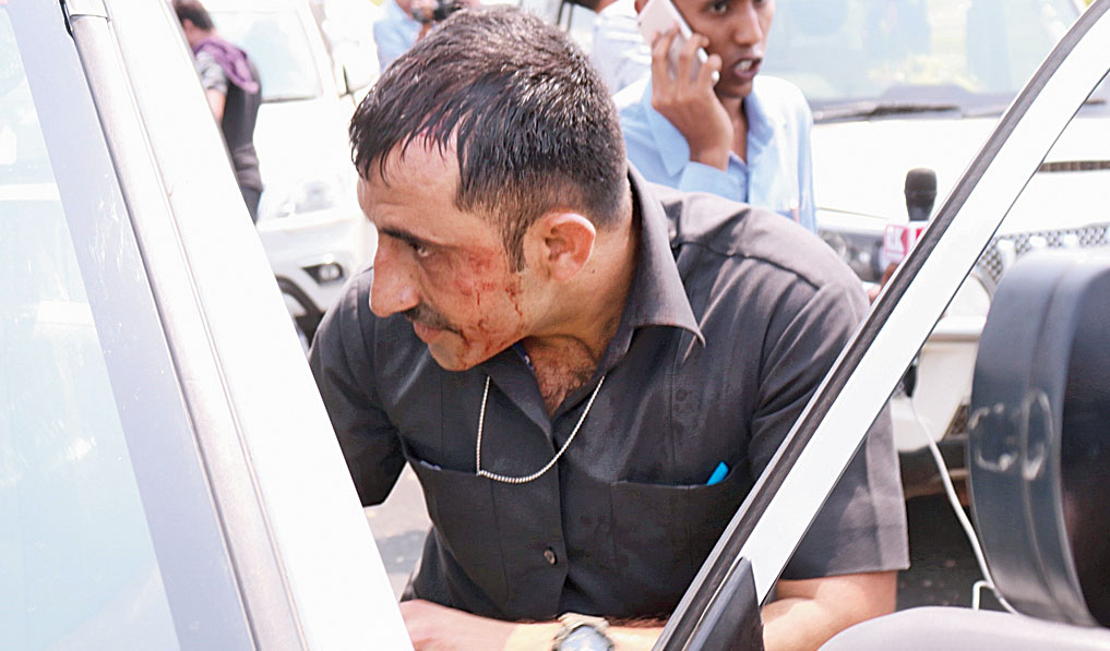 Ghosh’s injured security guard
