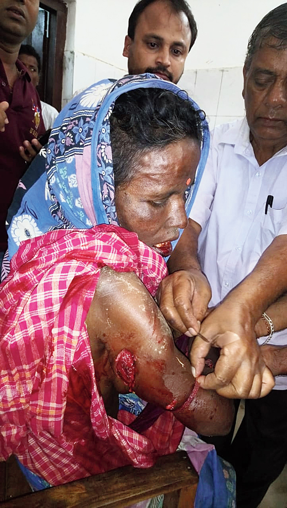 Chailla Das undergoes treatment at the hospital. 