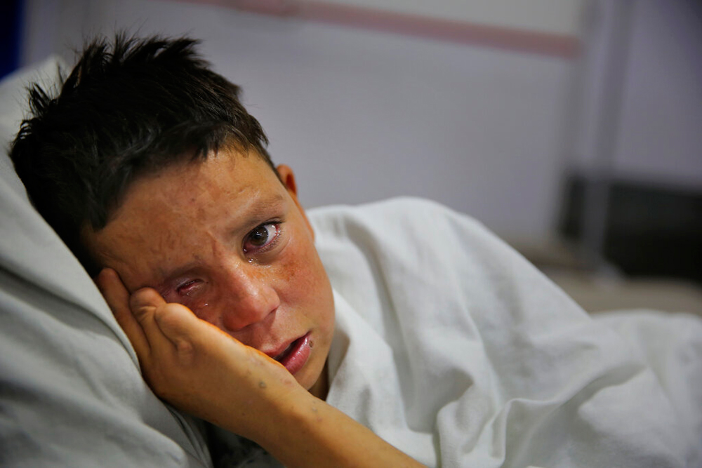 Farshid, 13, cries while lying on a hospital bed in Kabul. The total number of children killed or maimed in more than four decades long Afghan war is not known