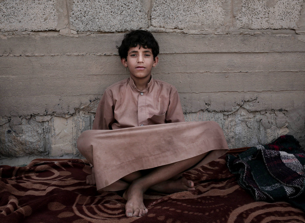 Morsal, 14, at a camp for displaced persons where he took shelter in Marib, Yemen. He said Houthi rebels took him from a soccer pitch where he was playing with his friends after school and forcibly enlisted him. He suffers from hearing loss from the sound of explosions and airstrikes.