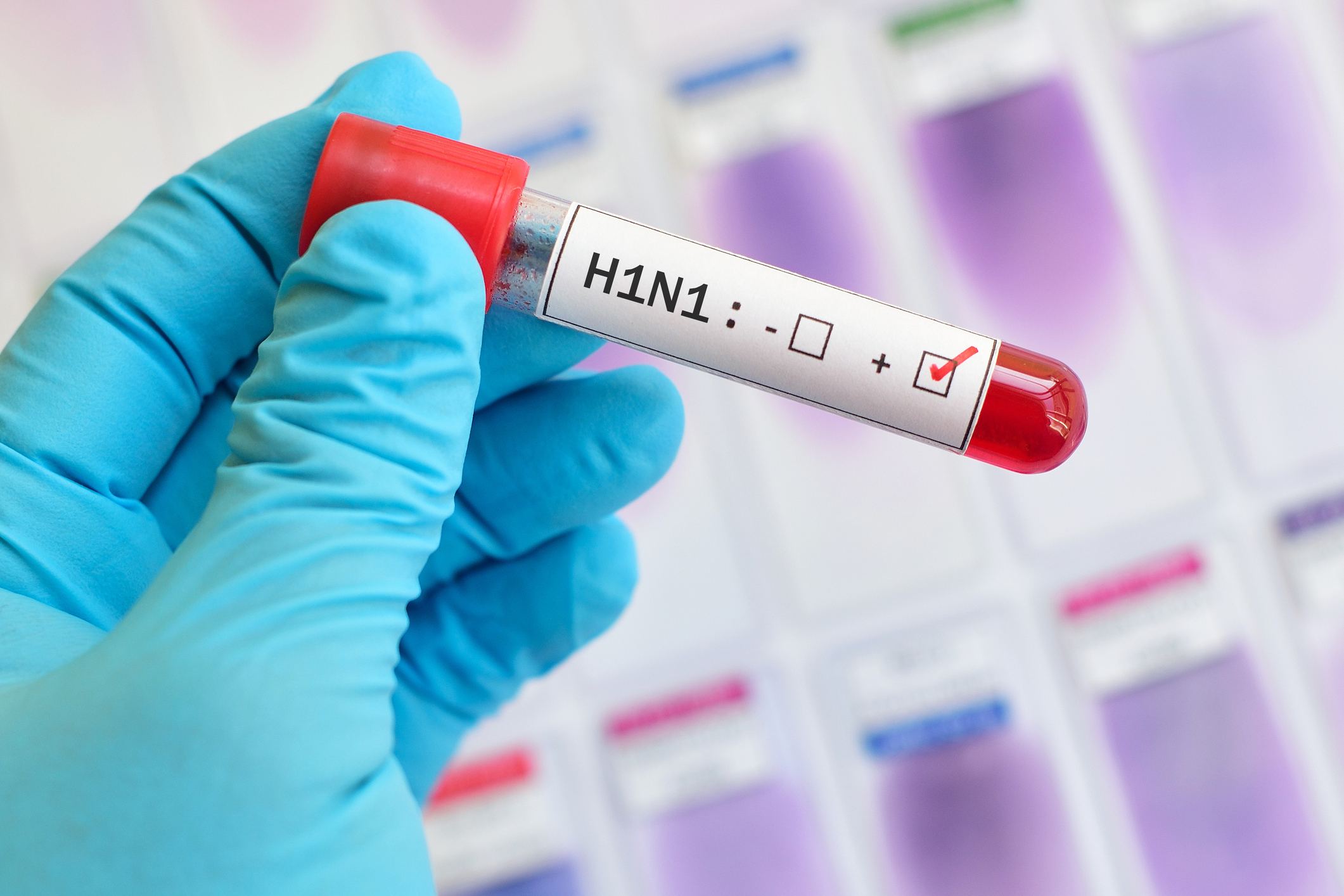 Swine flu, or H1N1 flu, is caused by a strain of the influenza family of viruses that is endemic in pigs.
