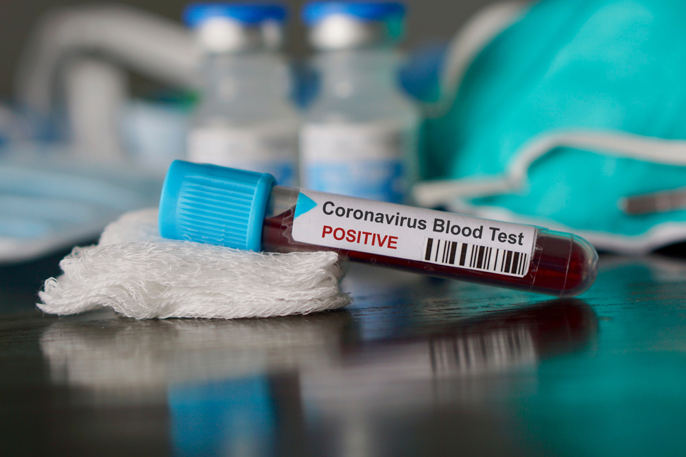 coronavirus-pandemic-covid-19-data-norms-for-private-hospitals-telegraph-india