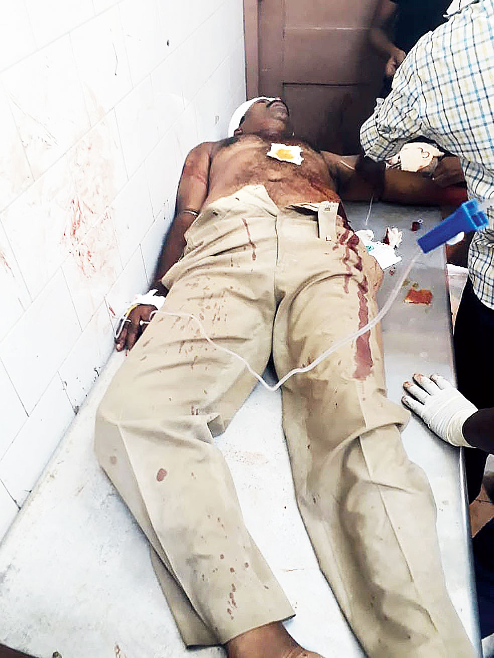 One of the two policemen who suffered bullet wounds during the escape bid by Bera