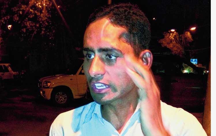 Danish, Akhlaque’s younger son, who was thrashed by the mob and critically injured. He was in coma and had to undergo three back-to-back brain surgeries. The scar is visible on his forehead