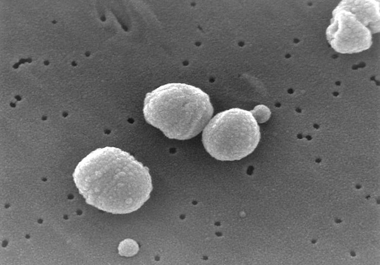 The bacterium Streptococcus pneumoniae, a common cause of pneumonia, imaged by an electron microscope