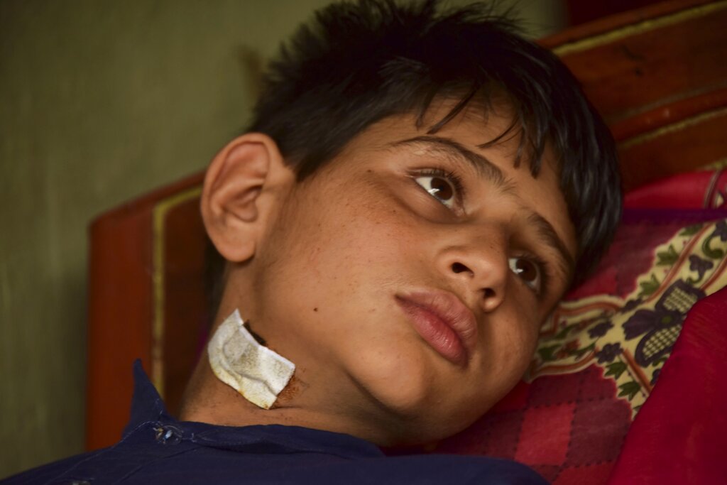 Pakistani Kashmiri boy Fakhar, 11, who was allegedly injured by an artillery fired across the border, rests at his home in Chilana, situated at the Line of Control between Pakistan and India, on Friday, Aug. 9, 2019